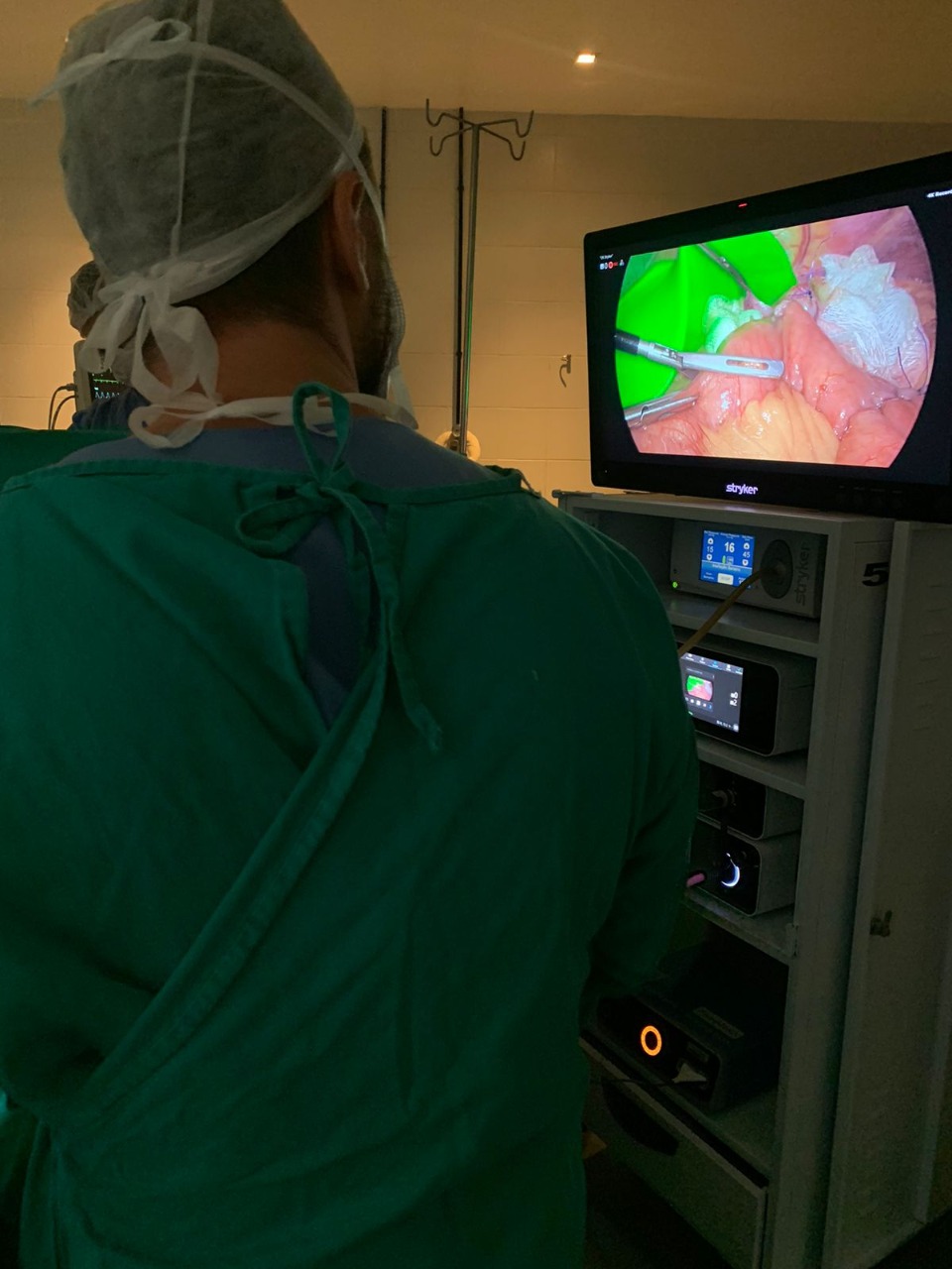 Primeira gastrectomia total por videolaparoscopia é realizada no Hospital Azambuja